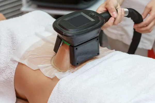 Image of person having fat freezing treatment to help weight gain Maryhill