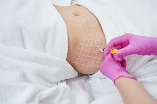 image of fat dissolving injections on love handles to help combat weight gain Maryhill