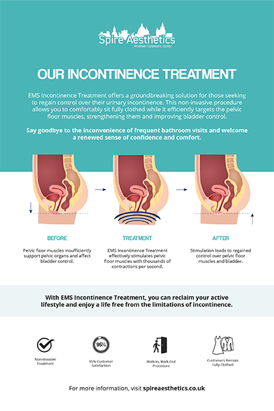 image of how urge incontinence Maryhill treatment works